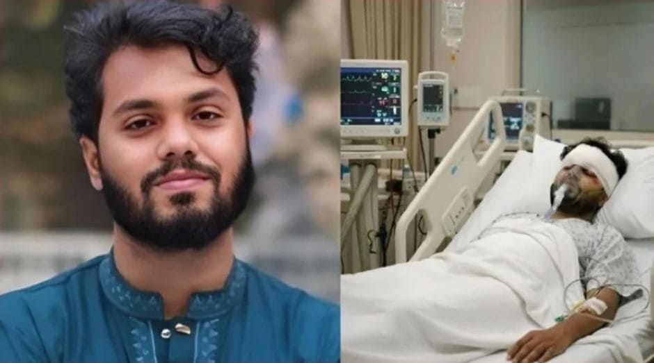 হাদির ব্রেন সক্রিয় করতে অপারেশন প্রয়োজন ,অবস্থা এখনও সংকটাপন্ন